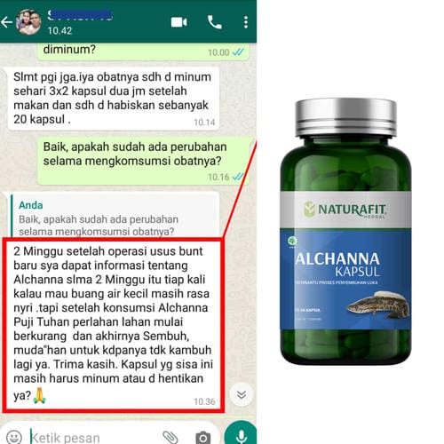 Testimoni Alchanna untuk operasi usus buntu