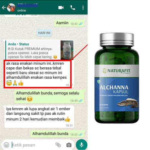 Testimoni Alchanna untuk pasca operasi