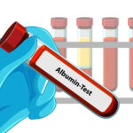 Albumin: Fungsi, Manfaat, dan Cara Meningkatkannya Secara Alami
