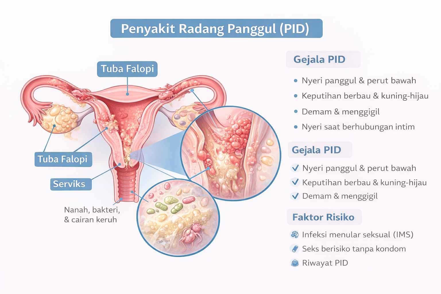 Penyakit radang panggul dan gejalanya