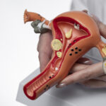 7 Penyakit pada Reproduksi Wanita yang Sering Diabaikan