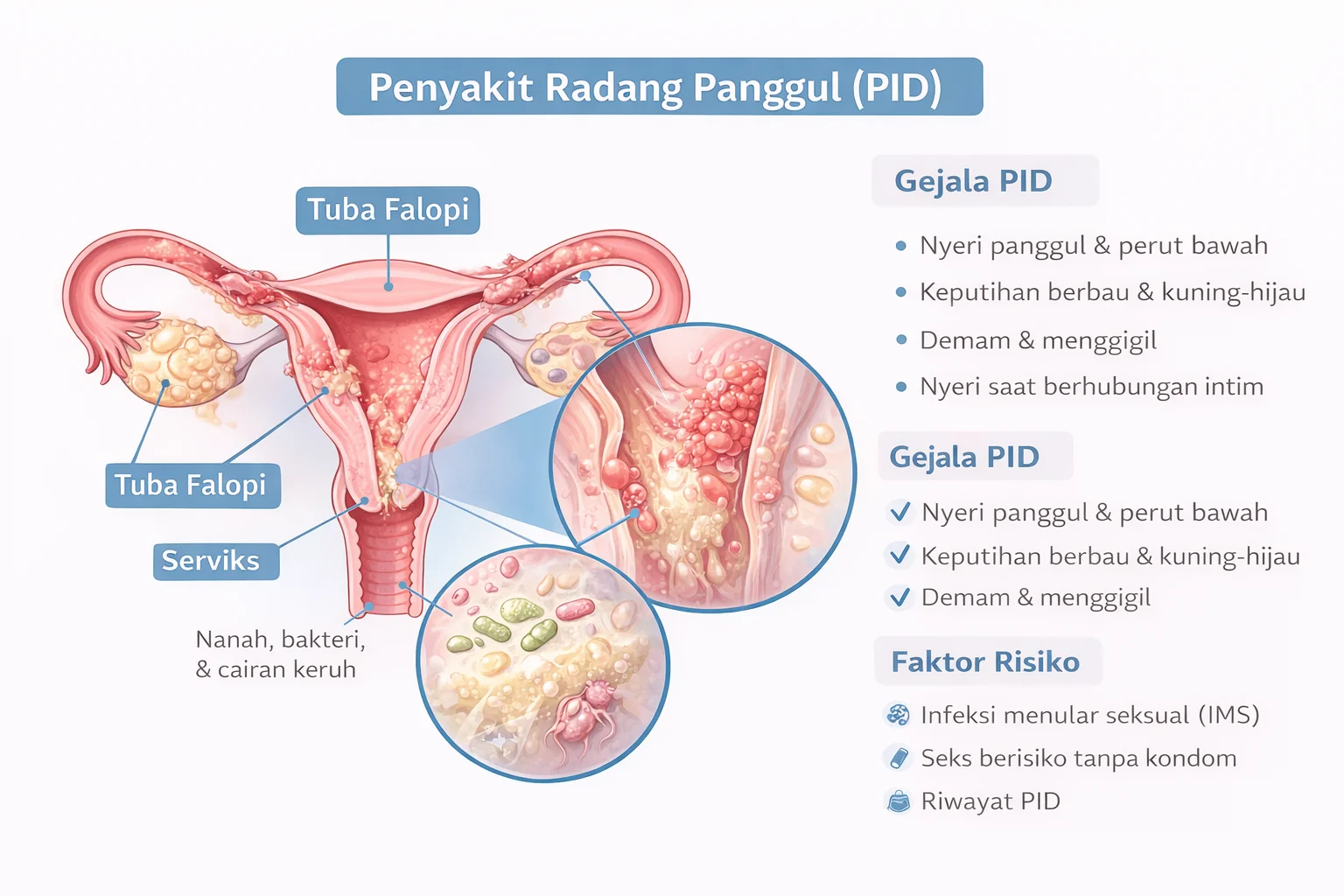 Penyakit radang panggul dan gejalanya